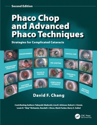 bokomslag Phaco Chop and Advanced Phaco Techniques