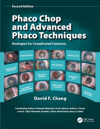 David F. Chang - Phaco Chop and Advanced Phaco Techniques, Inbunden