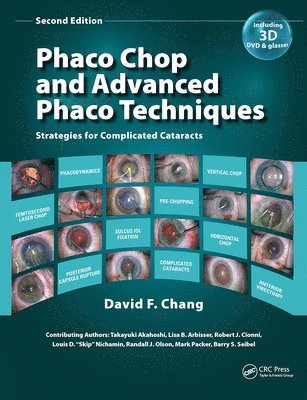 bokomslag Phaco Chop and Advanced Phaco Techniques