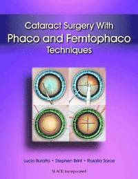 bokomslag Cataract Surgery With Phaco and Femtophaco Techniques