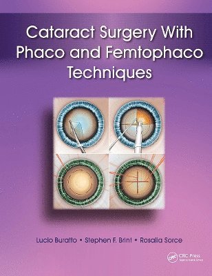 Cataract Surgery with Phaco and Femtophaco Techniques 1