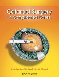 bokomslag Cataract Surgery in Complicated Cases