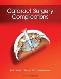 bokomslag Cataract Surgery Complications