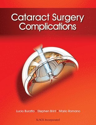 Cataract Surgery Complications 1
