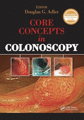 Core Concepts in Colonoscopy 1