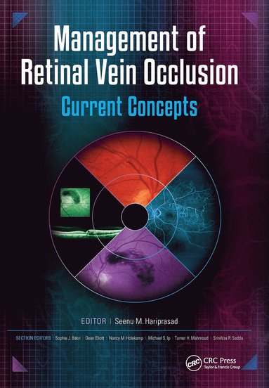 bokomslag Management of Retinal Vein Occlusion