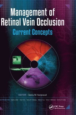 Management of Retinal Vein Occlusion 1