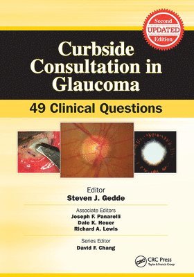 bokomslag Curbside Consultation in Glaucoma