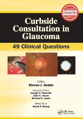 Curbside Consultation in Glaucoma 1