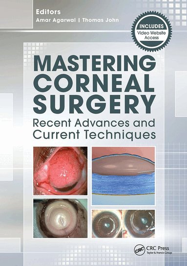 Amar Agarwal, Thomas John - Mastering Corneal Surgery, Häftad