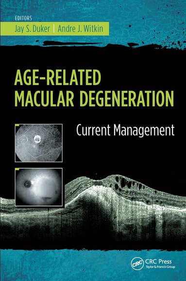 Jay Duker, Andre Witkin - Age-Related Macular Degeneration, Häftad
