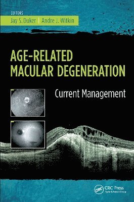 bokomslag Age-Related Macular Degeneration