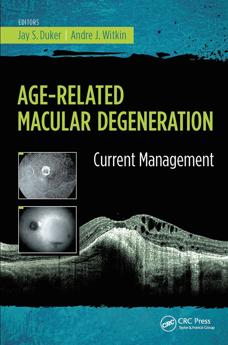 Jay Duker, Andre Witkin - Age-Related Macular Degeneration, Häftad