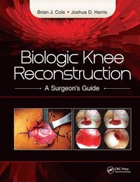 bokomslag Biologic Knee Reconstruction