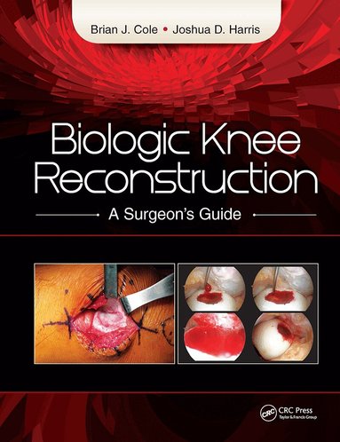 Brian Cole, Joshua Harris - Biologic Knee Reconstruction, Inbunden