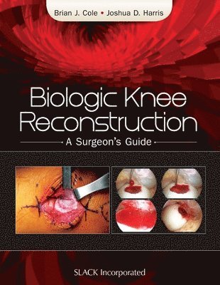 bokomslag Biologic Knee Reconstruction
