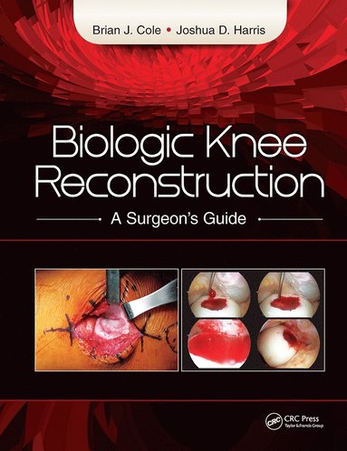 bokomslag Biologic Knee Reconstruction