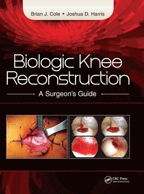 Biologic Knee Reconstruction 1