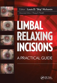 bokomslag Limbal Relaxing Incisions