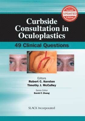 bokomslag Curbside Consultation in Oculoplastics