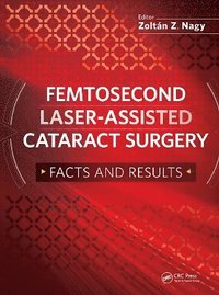 bokomslag Femtosecond Laser-Assisted Cataract Surgery