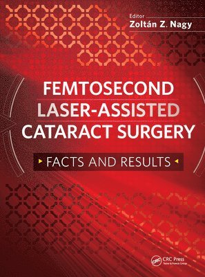 Zoltan Nagy - Femtosecond Laser-Assisted Cataract Surgery, Häftad