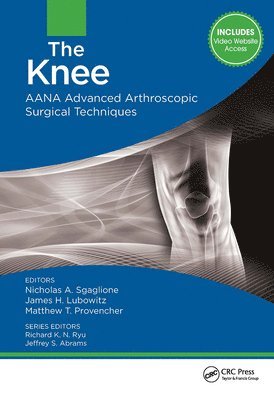 Nicholas Sgaglione, James Lubowitz, Matthew Provencher - Knee, Inbunden