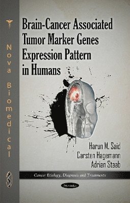 bokomslag Brain-Cancer Associated Tumor Marker Genes Expression Pattern in Humans