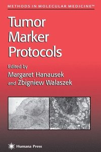 bokomslag Tumor Marker Protocols