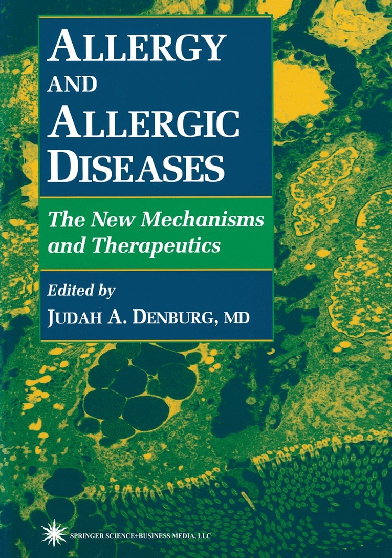 Judah A. Denburg - Allergy and Allergic Diseases, Häftad