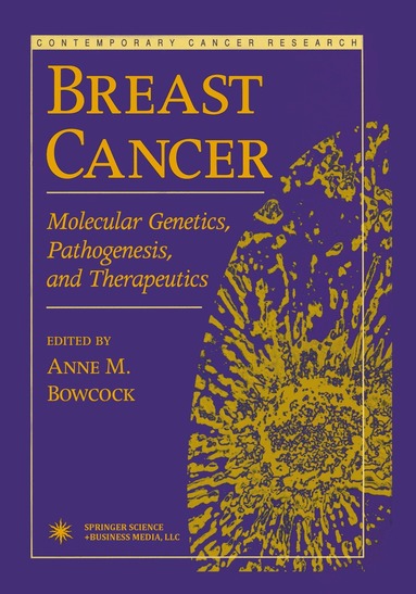 Anne M. Bowcock - Breast Cancer, Häftad