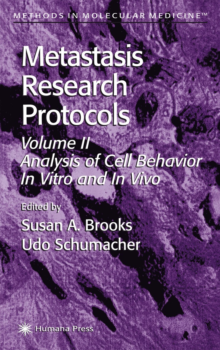 Susan A. Brooks, Udo Schumacher, Susan A Brooks - Metastasis Research Protocols, Häftad