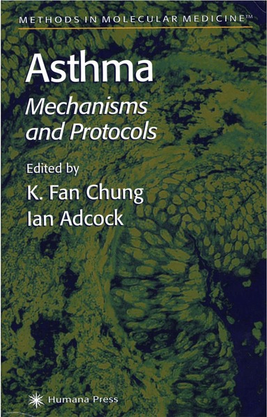 K. Fan Chung, Ian Adcock - Asthma, Häftad