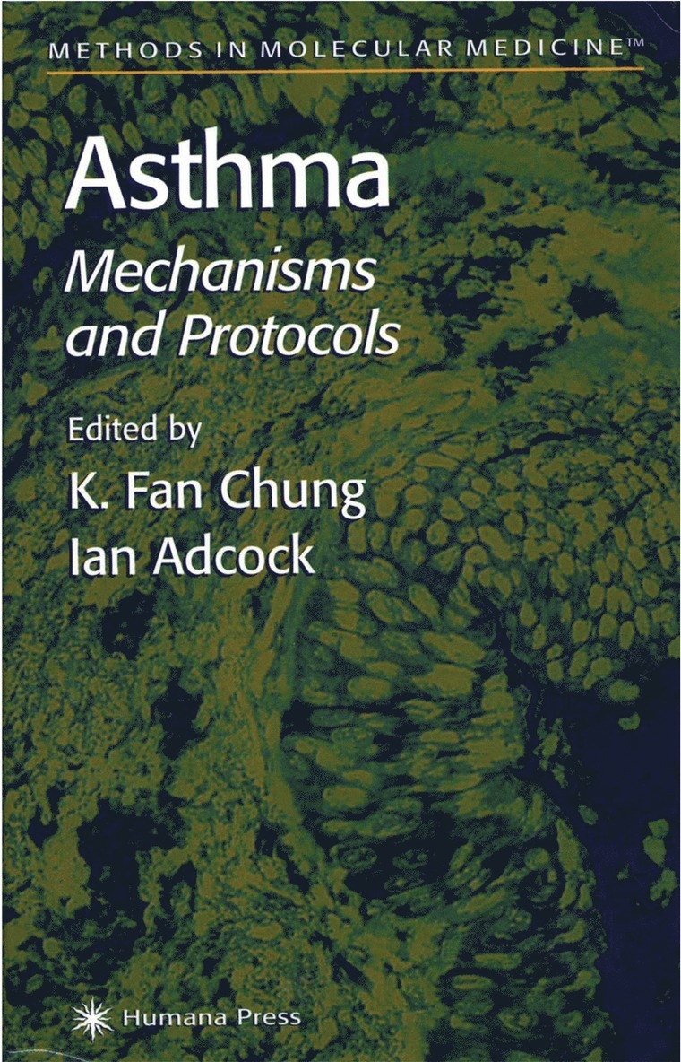 K. Fan Chung, Ian Adcock - Asthma, Häftad
