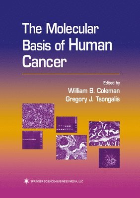 bokomslag The Molecular Basis of Human Cancer