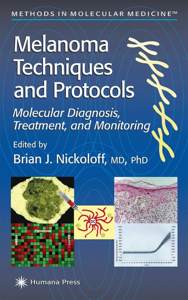 Brian J. Nickoloff - Melanoma Techniques and Protocols, Häftad