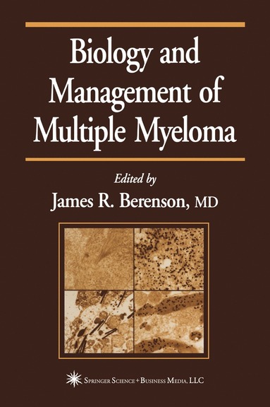 bokomslag Biology and Management of Multiple Myeloma