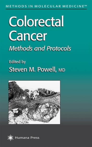 Steven M. Powell - Colorectal Cancer, Häftad
