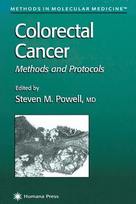 Steven M. Powell, Steven M Powell - Colorectal Cancer, Häftad