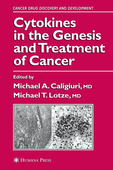 Michael A. Caligiuri, Michael T. Lotze - Cytokines in the Genesis and Treatment of Cancer, Häftad