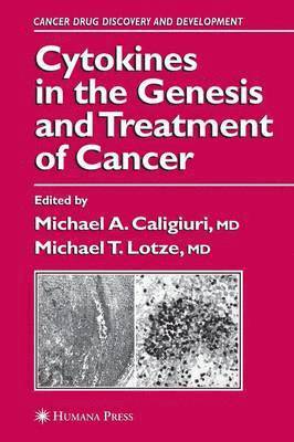 Cytokines in the Genesis and Treatment of Cancer 1