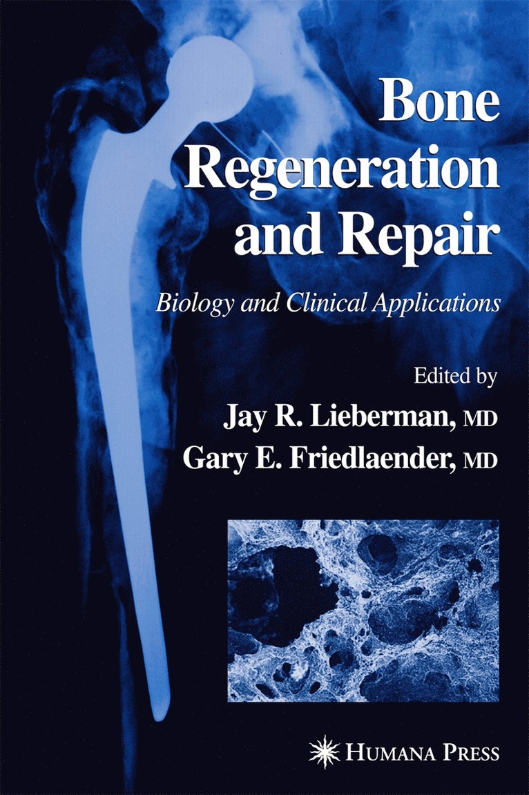 Jay R. Lieberman, Gary E. Friedlaender, M.D. Friedlaender, Gary E., Jay R Lieberman, Gary E Friedlaender - Bone Regeneration and Repair, Häftad