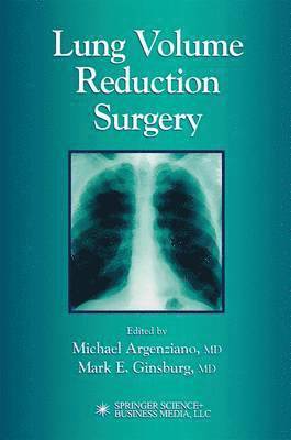 Lung Volume Reduction Surgery 1