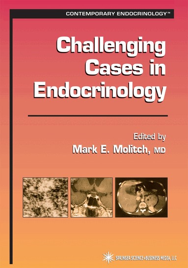 Mark E. Molitch - Challenging Cases in Endocrinology, Häftad