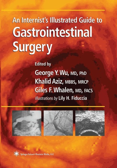 George Y. Wu - Internist’s Illustrated Guide to Gastrointestinal Surgery, Häftad
