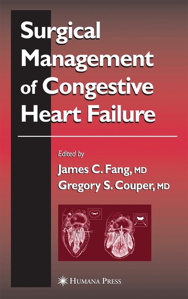 James C. Fang, Gregory S. Couper - Surgical Management of Congestive Heart Failure, Häftad