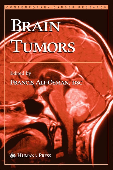 bokomslag Brain Tumors