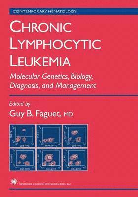 Chronic Lymphocytic Leukemia 1