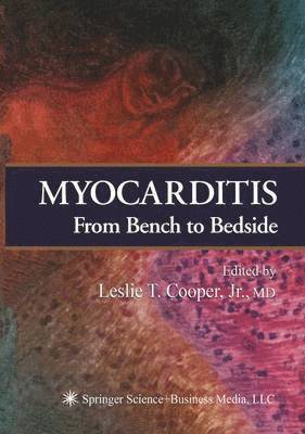 Myocarditis 1