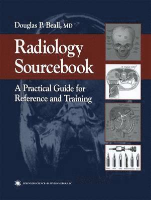 Douglas P. Beall - Radiology Sourcebook, Häftad